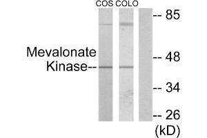 Western blot analysis of extracts from COS-7 cells and COLO205 cells, using Mevalonate Kinase antibody. (MVK anticorps  (Internal Region))
