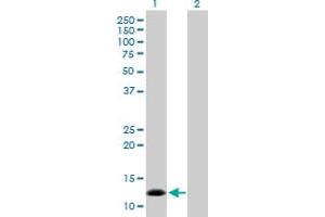 Lane 1: NPPB transfected lysate ( 14. (NPPB 293T Cell Transient Overexpression Lysate(Denatured))