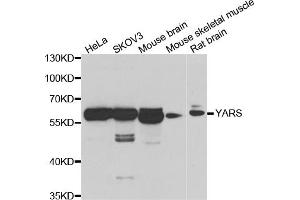 Western blot analysis of extracts of various cell lines, using YARS antibody (ABIN5974115) at 1/1000 dilution. (YARS anticorps)