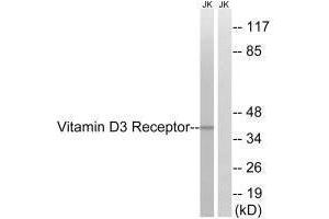 Western blot analysis of extracts from Jurkat cells, using Vitamin D3 Receptor (Ab-51) antibody. (Vitamin D Receptor anticorps  (Ser51))