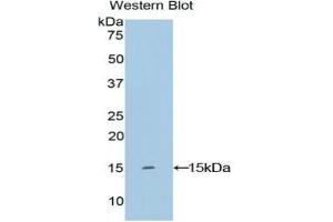 Detection of Recombinant KRT2, Human using Polyclonal Antibody to Keratin 2 (CK2) (Keratin 2 anticorps  (AA 7-160))