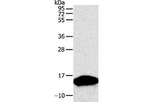 Western blot analysis of Human fetal brain tissue, using PVALB Polyclonal Antibody at dilution of 1:300 (PVALB anticorps)