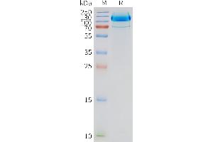 Human -Nanodisc, Flag Tag on SDS-PAGE (GRM2 Protéine)
