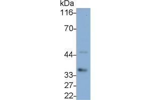 Detection of IL1b in Canine Pancreas lysate using Polyclonal Antibody to Interleukin 1 Beta (IL1b) (IL-1 beta anticorps  (AA 103-260))