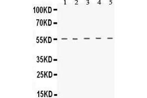 Western Blotting (WB) image for anti-Tachykinin Receptor 1 (TACR1) (AA 264-291), (C-Term) antibody (ABIN3043942) (TACR1 anticorps  (C-Term))