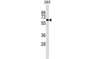 Western Blotting (WB) image for anti-UDP Glucuronosyltransferase 2 Family, Polypeptide B10 (UGT2B10) antibody (ABIN2999294) (UGT2B10 anticorps)