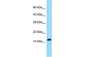 WB Suggested Anti-VKORC1 Antibody Titration: 1. (VKORC1 anticorps  (N-Term))