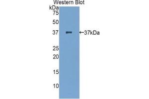 Detection of Recombinant zAP70, Mouse using Polyclonal Antibody to Zeta Chain Associated Protein Kinase 70 kDa (zAP70) (ZAP70 anticorps  (AA 270-560))