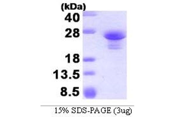 ASF1A Protein (AA 1-204) (His tag)