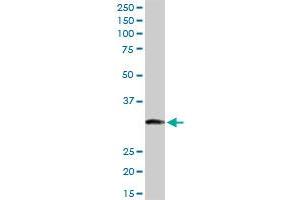 ITPK1 MaxPab rabbit polyclonal antibody. (ITPK1 anticorps  (AA 1-314))