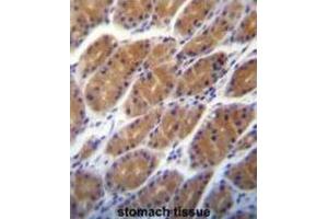 Immunohistochemistry (IHC) image for anti-Claudin 2 (CLDN2) antibody (ABIN2996860) (Claudin 2 anticorps)