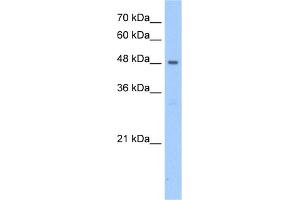 WB Suggested Anti-PNPLA5 Antibody Titration:  2. (PNPLA5 anticorps  (N-Term))