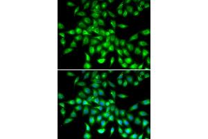 Immunofluorescence analysis of  cells using SERPIN antibody . (SERPINA10 anticorps  (AA 165-444))