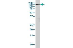 Western Blotting (WB) image for anti-RPTOR Independent Companion of mTOR, Complex 2 (RICTOR) (AA 1-98) antibody (ABIN566975)