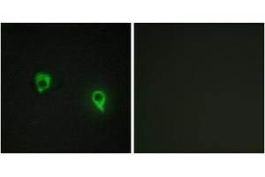 Immunofluorescence analysis of COS7 cells, using AKAP1 antibody. (AKAP1 anticorps  (Internal Region))