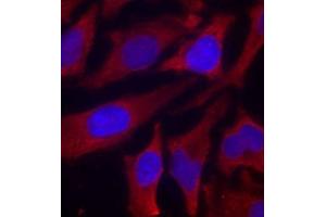Immunofluorescence staining of methanol-fixed HeLa cells using Phospho-SYN1-S9 antibody (ABIN2987713). (SYN1 anticorps  (pSer9))