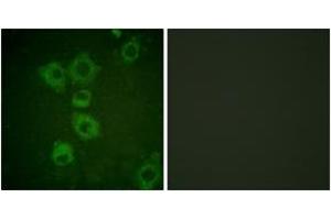 Immunofluorescence (IF) image for anti-Caspase 6, Apoptosis-Related Cysteine Peptidase (CASP6) (AA 223-272) antibody (ABIN2888590) (Caspase 6 anticorps  (AA 223-272))