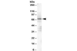 Western blot testing of human spleen lysate with PARP2 antibody at 1ug/ml. (PARP2 anticorps)