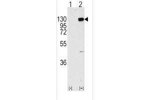 Western blot analysis of FGFR1 (arrow) using rabbit polyclonal FGFR1 Antibody  (R). (FGFR1 anticorps  (AA 744-773))