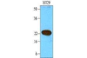 Cell lysates of HT29 (40 ug) were resolved by SDS-PAGE, transferred to nitrocellulose membrane and probed with anti-human CIB1 (1:1000). (CIB1 anticorps  (AA 1-191))