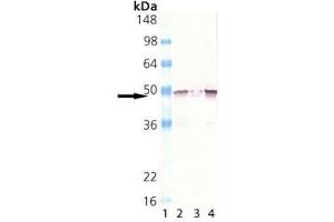 Western blot analysis of MEK1, pAb : Lane 1: MW marker, Lane 2: HeLa (heat shocked) , Lane 3: Rat spleen extract, Lane 4: Mouse brain extract (MEK1 anticorps  (N-Term))