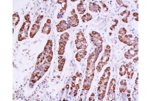 Immunohistochemistry (Paraffin-embedded Sections) (IHC (p)) image for anti-SRY (Sex Determining Region Y)-Box 2 (SOX2) (AA 227-317) antibody (ABIN669621)