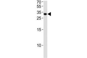 ASCL1 antibody western blot analysis in NCI-H460 lysate. (ASCL1 anticorps  (AA 63-90))