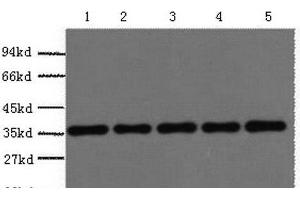 Western Blot analysis of 293T, Rat brain, NIH, 3T3, Sheep muscle, Rabbit testis using GAPDH Polyclonal Antibody at dilution of 1:5000. (GAPDH anticorps)