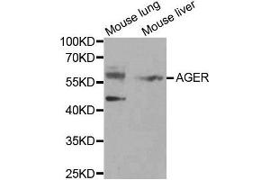 Western blot analysis of extracts of various tissues, using AGER antibody. (RAGE anticorps  (AA 30-330))