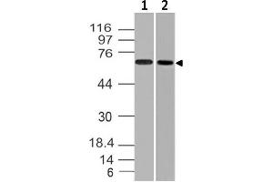 Image no. 1 for anti-Endoglin (ENG) (AA 43-287) antibody (ABIN5027187) (Endoglin anticorps  (AA 43-287))