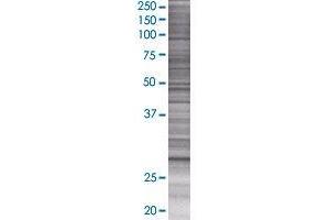 BPHL transfected lysate. (BPHL 293T Cell Transient Overexpression Lysate(Denatured))