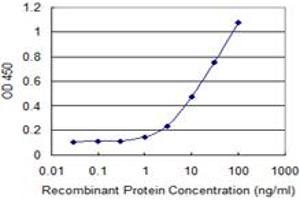 Detection limit for recombinant GST tagged HDAC6 is 0. (HDAC6 anticorps  (AA 1-1063))