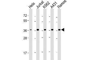 All lanes : Anti-RAD51 Antibody at 1:4000 dilution Lane 1: Hela whole cell lysate Lane 2: Jurkat whole cell lysate Lane 3: K562 whole cell lysate Lane 4: A431 whole cell lysate Lane 5: Ramos whole cell lysate Lysates/proteins at 20 μg per lane. (RAD51 anticorps  (AA 1-339))