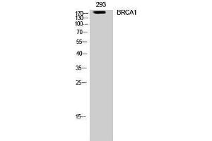 Western Blotting (WB) image for anti-Breast Cancer 1 (BRCA1) (Ser182) antibody (ABIN3183540) (BRCA1 anticorps  (Ser182))