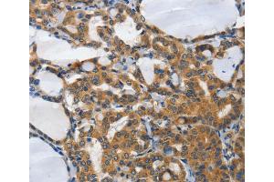 Immunohistochemistry (IHC) image for anti-Protein Inhibitor of Activated STAT, 2 (PIAS2) antibody (ABIN2434174) (PIAS2 anticorps)