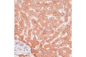 Immunohistochemistry of paraffin-embedded human liver using  antibody (ABIN6131192, ABIN6137264, ABIN6137265 and ABIN6215207) at dilution of 1:100 (40x lens). (ATG5 anticorps  (AA 28-275))