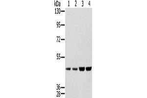 Western Blotting (WB) image for anti-Sjogren Syndrome Antigen B (SSB) antibody (ABIN2427328) (SSB anticorps)