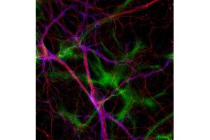 Immunocytochemistry (ICC) image for anti-Tubulin delta 2 (AA 443-449) antibody (ABIN1742551) (Tubulin delta 2 (AA 443-449) anticorps)