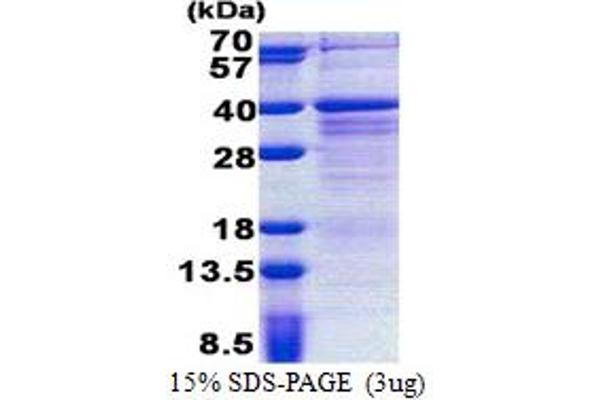 ZMAT3 Protein (AA 1-289) (His tag)