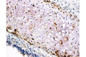 IHC-F testing of COL2A1 antibody and rat trachea tissue (COL2A1 anticorps  (C-Term))