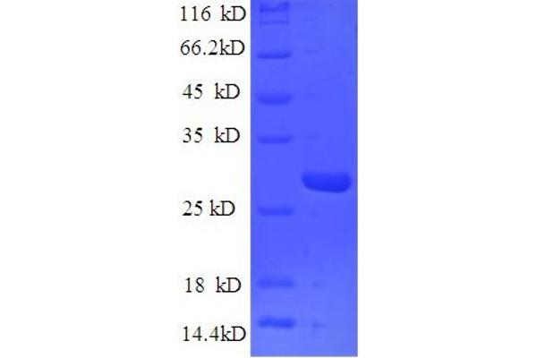 Nidogen 1 Protein (NID1) (AA 428-665) (His tag)