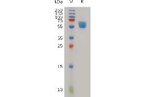 Human T Protein, hFc Tag on SDS-PAGE under reducing condition. (TREM1 Protein (AA 21-200) (Fc Tag))