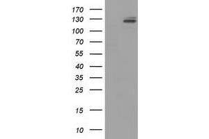 HEK293T cells were transfected with the pCMV6-ENTRY control (Left lane) or pCMV6-ENTRY L1CAM (Right lane) cDNA for 48 hrs and lysed. (L1CAM anticorps)