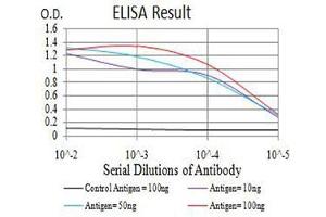 Black line: Control Antigen (100 ng),Purple line: Antigen (10 ng), Blue line: Antigen (50 ng), Red line:Antigen (100 ng) (ADAMTS1 anticorps  (AA 858-960))