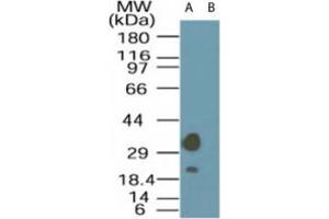 Image no. 1 for anti-STE20-Related Kinase Adaptor alpha (STRADA) (AA 300-350) antibody (ABIN200008) (STRADA anticorps  (AA 300-350))