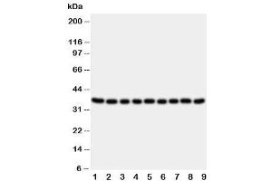 Western blot testing of Kallikrein 10 antibody and Lane 1:  rat ovary (Kallikrein 10 anticorps  (C-Term))