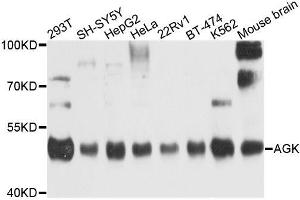 Western blot analysis of extracts of various cell lines, using AGK antibody (ABIN6003685) at 1/1000 dilution. (Acylglycerol Kinase anticorps)
