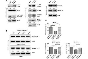 Western Blotting (WB) image for anti-Sequestosome 1 (SQSTM1) antibody (ABIN2854836)