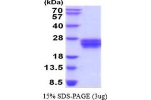 SDS-PAGE (SDS) image for Fms-Related tyrosine Kinase 3 Ligand (FLT3LG) (AA 27-184) protein (His tag) (ABIN7529305) (FLT3LG Protein (AA 27-184) (His tag))