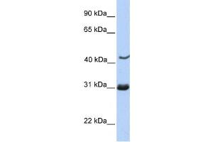 Western Blotting (WB) image for anti-Nucleoporin 35kDa (NUP35) antibody (ABIN2459542) (NUP35 anticorps)